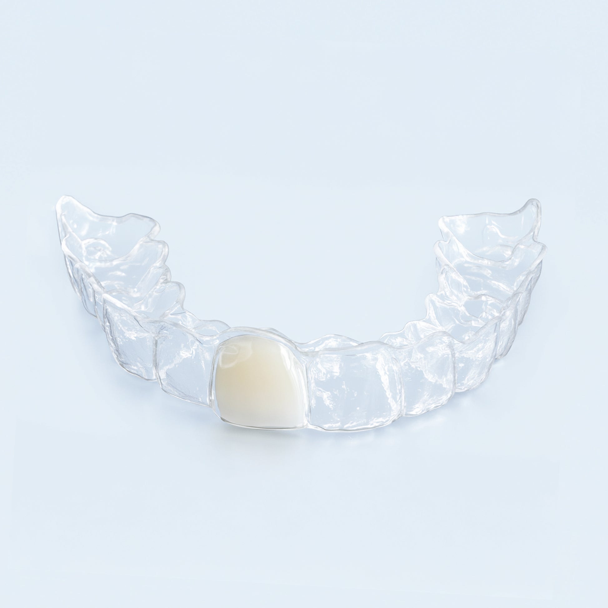 Clear upper retainer with built-in replacement tooth on blue surface for missing tooth