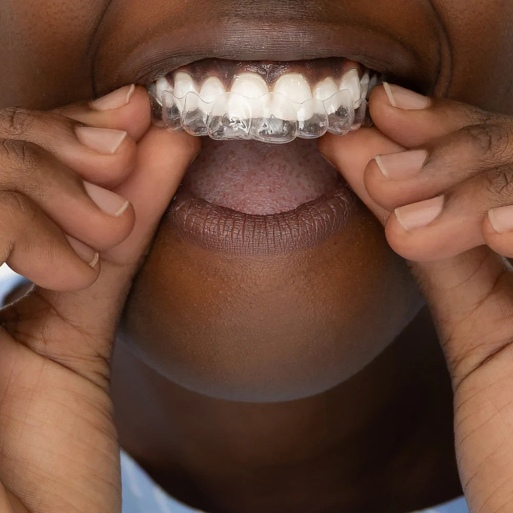Person holding a clear dental aligner with their fingers.