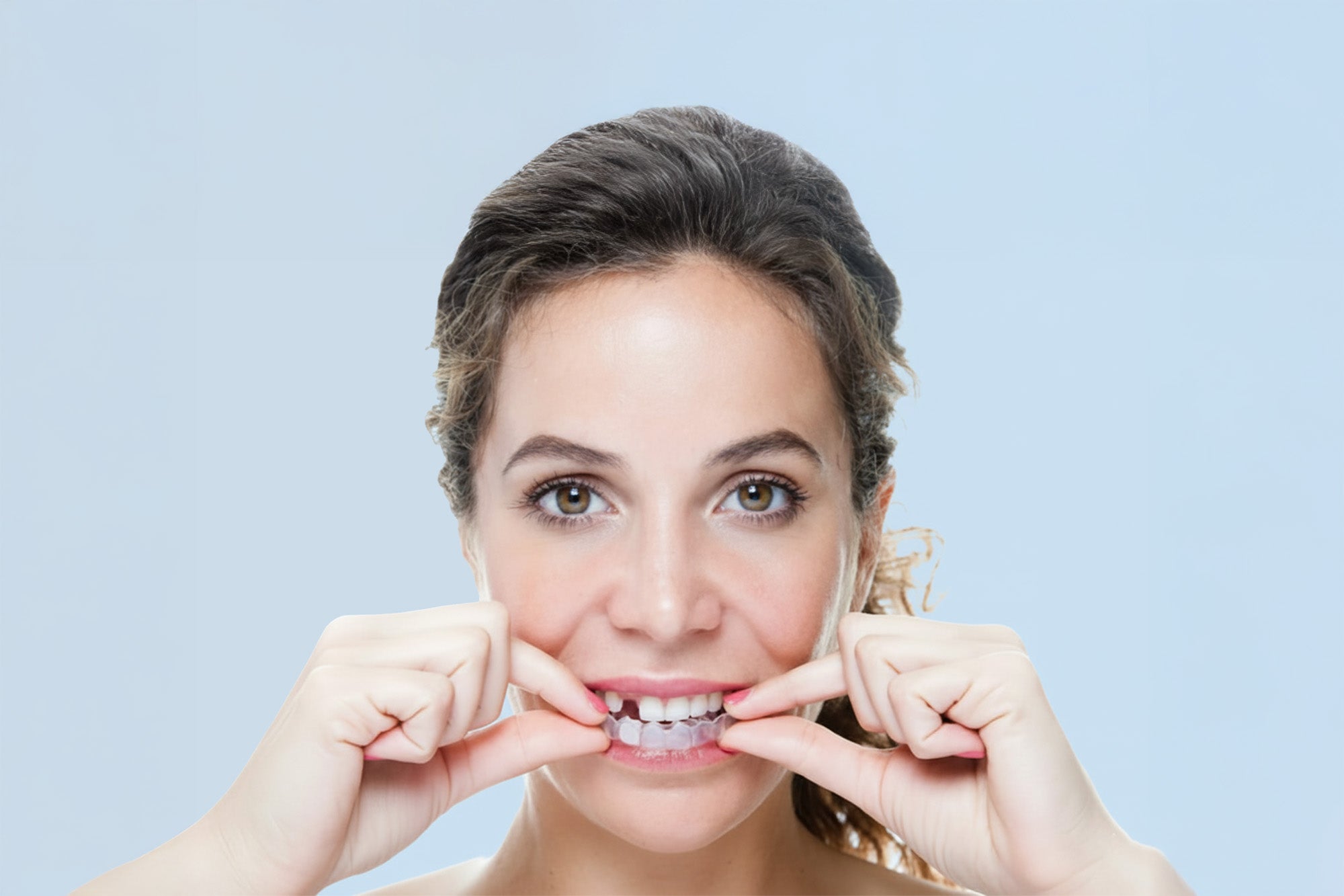 Woman wearing missing tooth pontic essix retainer with fake tooth