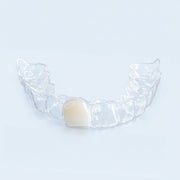 Missing Tooth Retainer, Instant Smile Fix