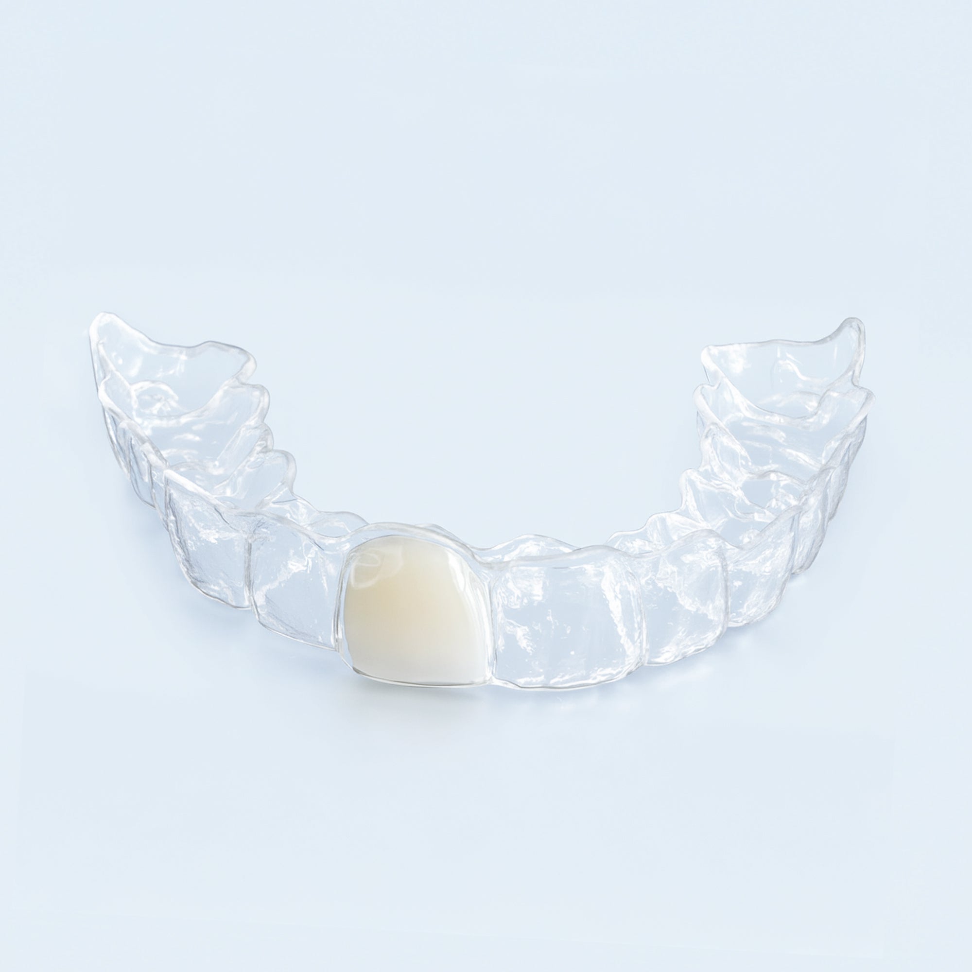 Clear upper retainer with built-in replacement tooth on blue surface for missing tooth