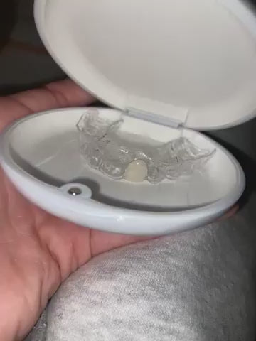 Pontic missing tooth essix retainer with fake tooth and travel case