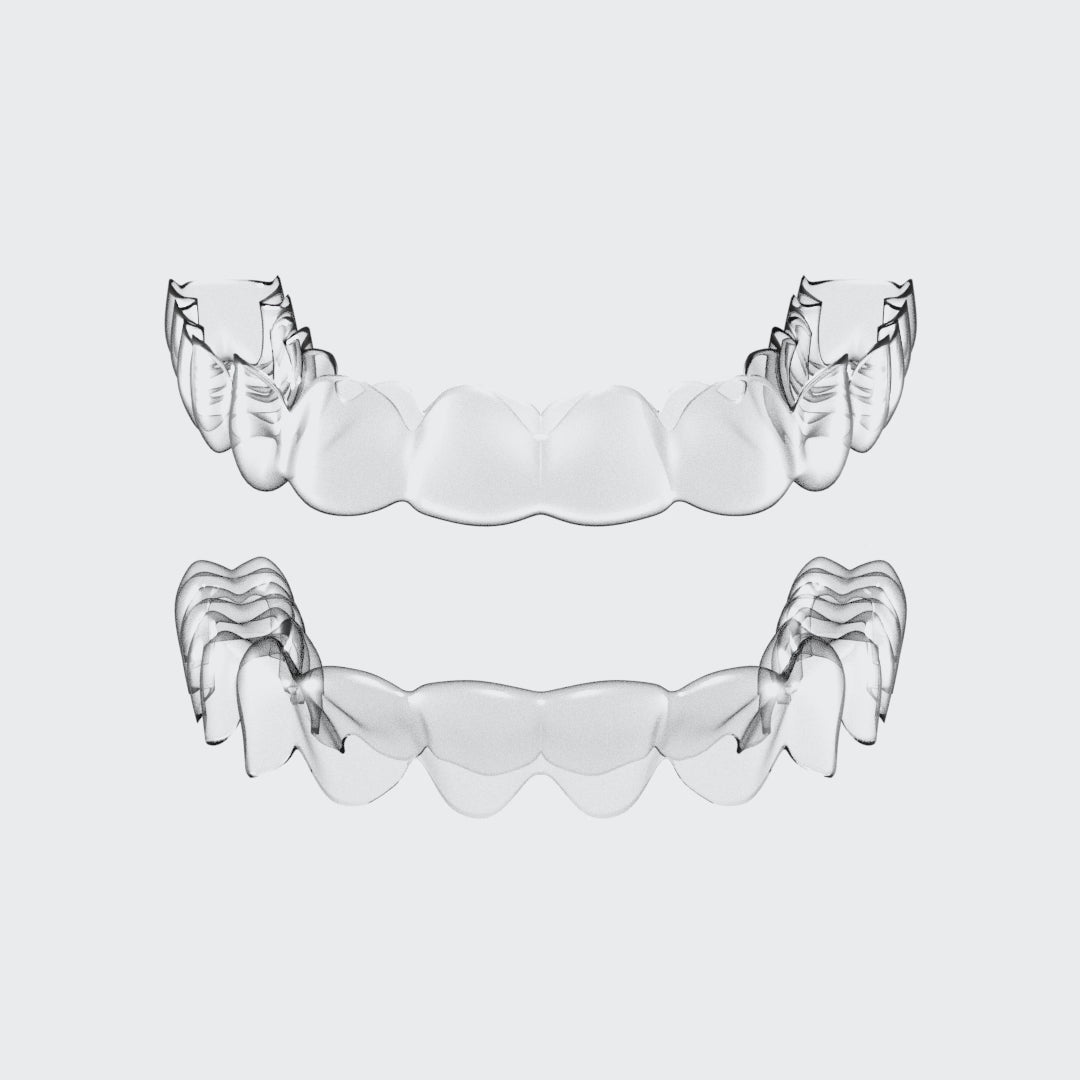 Load video: Upper &amp; Lower 1.0mm Essix Retainers (Scalloped)