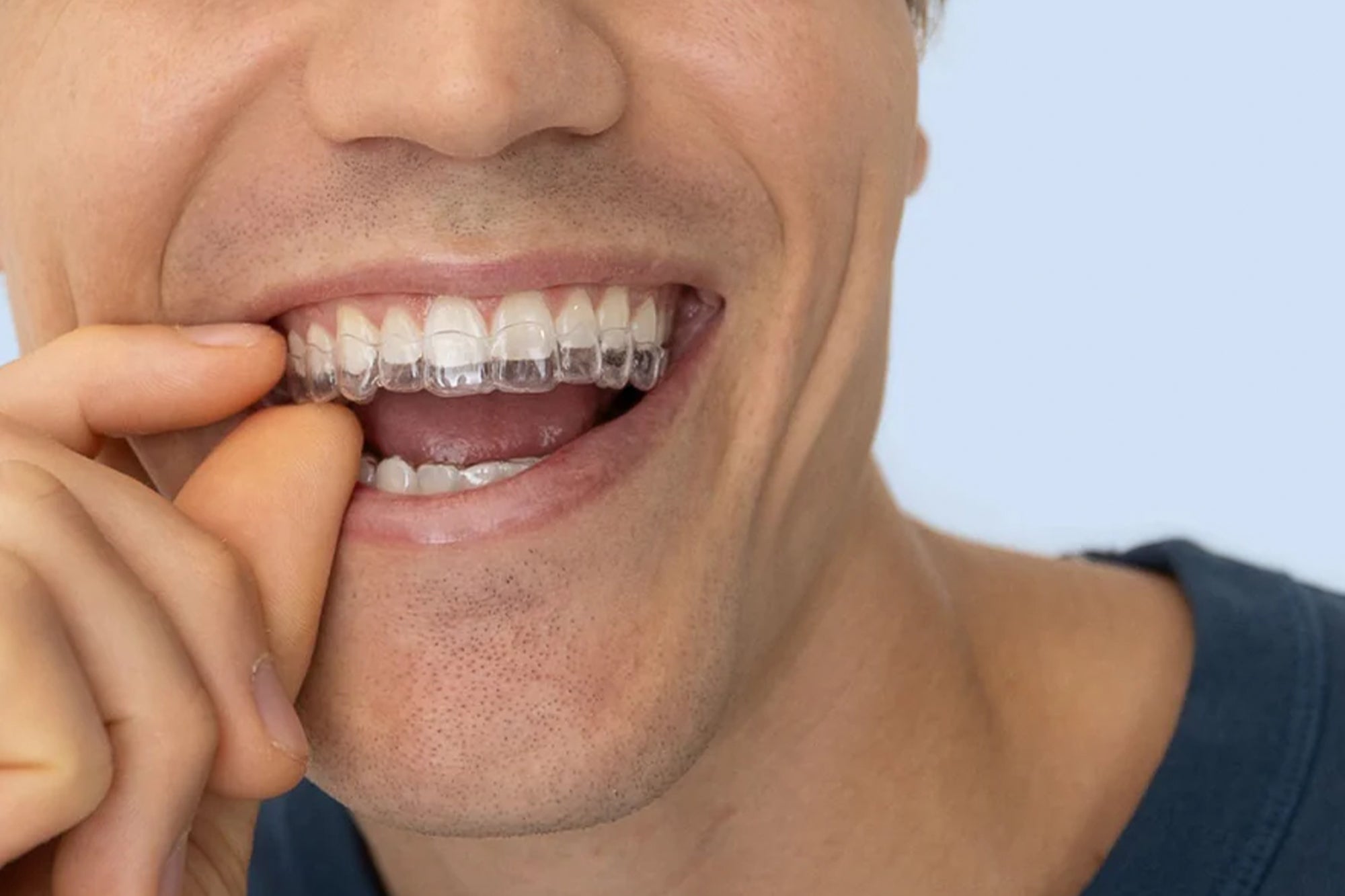 man holding clear aligner and a blue top