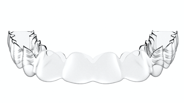 Extra Scalloped Retainer