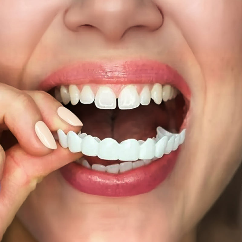 woman wearing snap on smile